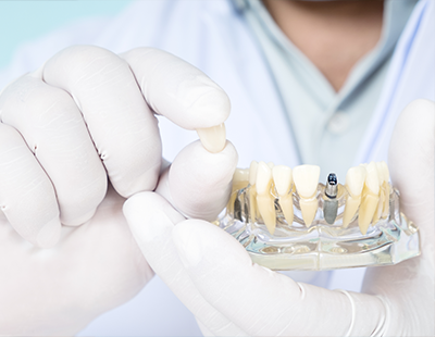 Schaumburg Dental Office