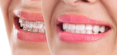 Corey J. Walther, DDS   Associates | Cosmetic Dentistry, Night Guards and CEREC